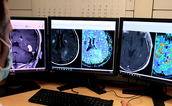 Investigadors catalans creen una eina amb intel·ligència artificial per millorar el diagnòstic dels tumors cerebrals